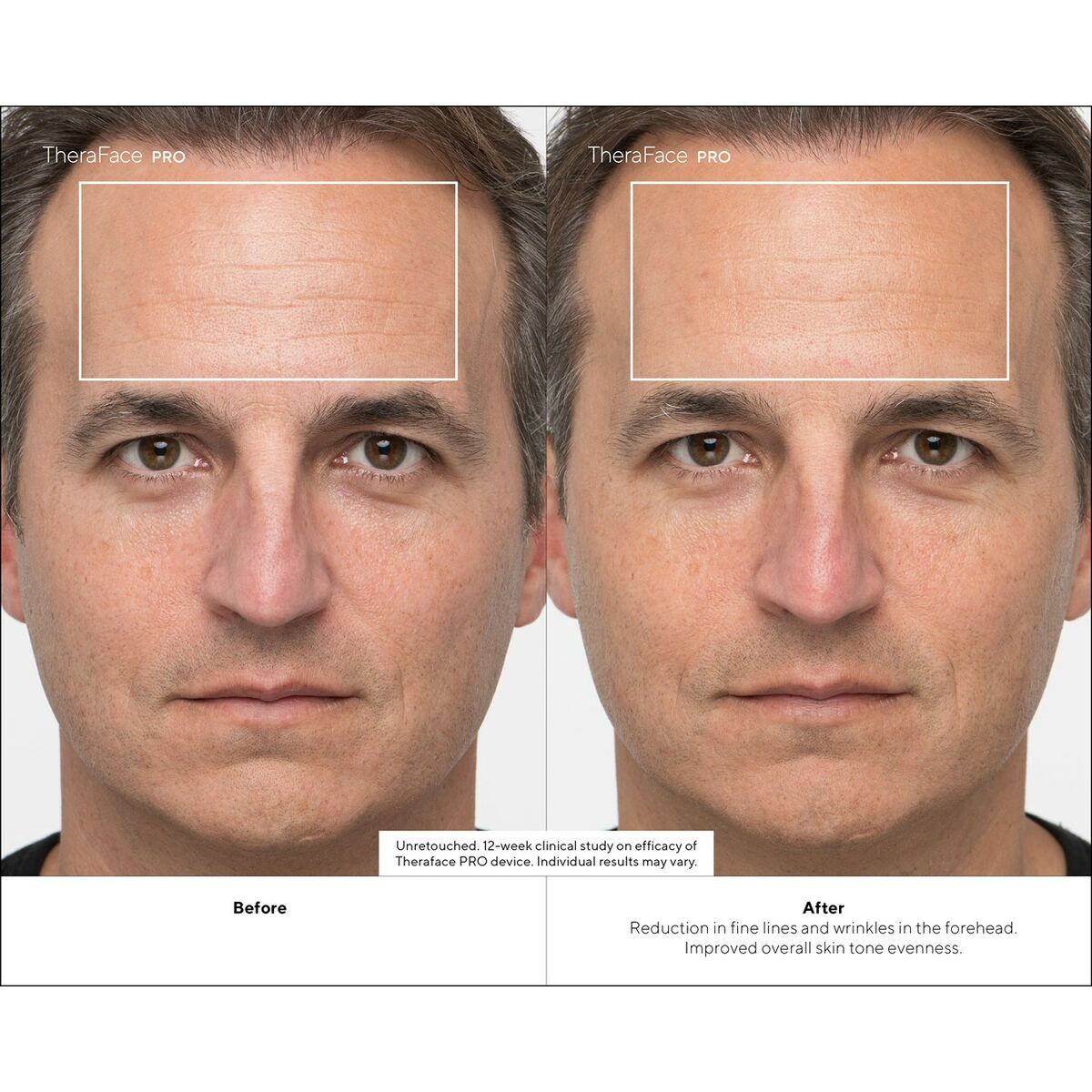 V4HF4AAD1C52DF16820D85AF27229C01803R4939060P10